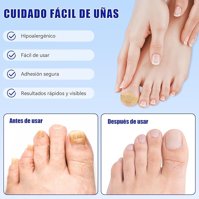 PACK 2 Parche hongo De Uñas (42unid)