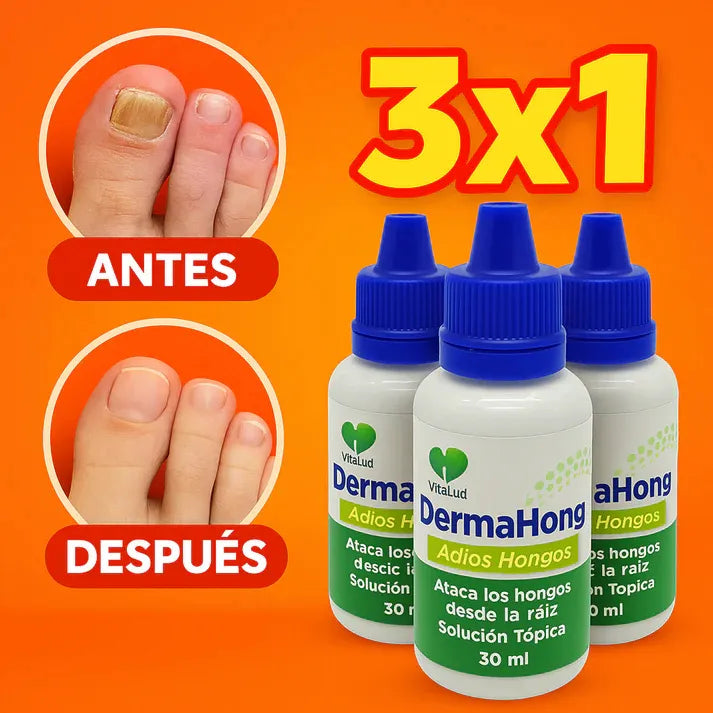 DERMAHONG - Elimina de raíz cualquier hongo